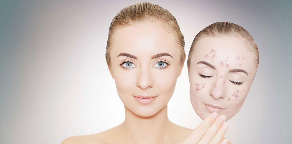 cilt lekeleri için doğal maske tarifleri