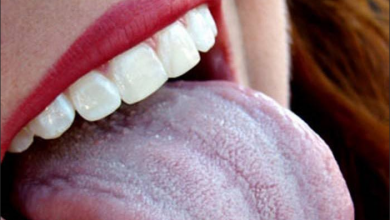 Dildeki Pamukçuk Neden Olur? Nasıl Geçer?