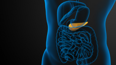 Pankreas Kanseri Belirtileri Nedir? Nasıl Tedavi Edilir?