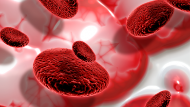 Demir İçeren Besinler Hangileridir?